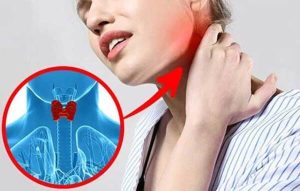 nguoi-bi-tuyen-giap-co-uong-sam-duoc-khong-4