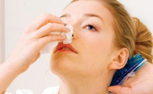 nguyên nhân ăn nhân sâm chảy máu mũi