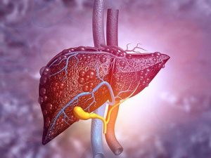 Bệnh xơ gan là gì